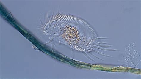 Trumpet Ciliate: A Master of Molecular Manipulation That Swims with Cilia!