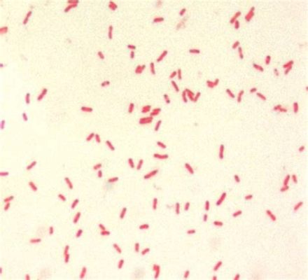  Yersinia pestis: This Tiny Blood-Sucking Worm Is Responsible For A Plague That Once Devastated Humanity!