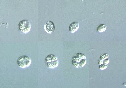 Polytoma!  A Freshwater Protist With Fascinating Feeding Habits That Will Leave You Speechless!